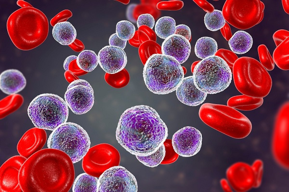 ERYTECH étend son étude de Phase IIb dans la Leucémie Aiguë Myéloïde