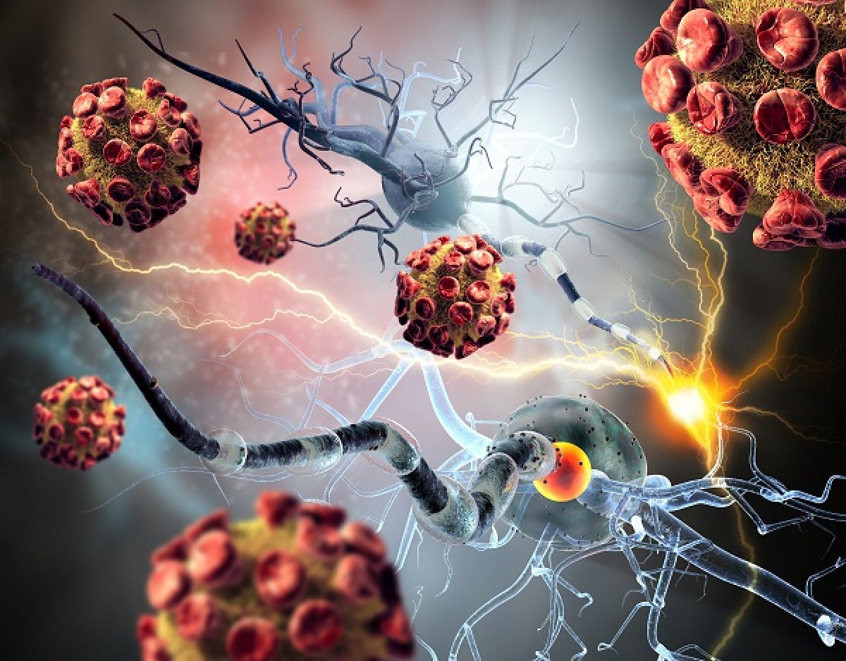 Le test MGMT de MDxHealth identifie les patients atteints d'un cancer du cerveau